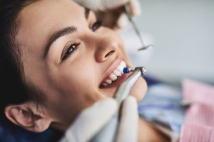 Maintaining a Healthy Smile with Teeth Polishing